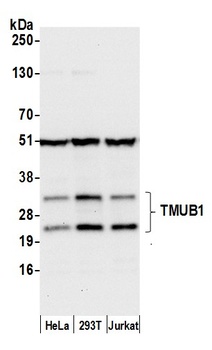 Rabbit TMUB1 Antibody