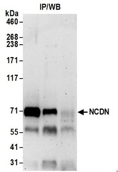 Rabbit NCDN Antibody