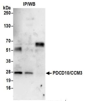Rabbit PDCD10/CCM3 Antibody