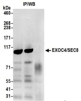 Rabbit EXOC4/SEC8 Antibody