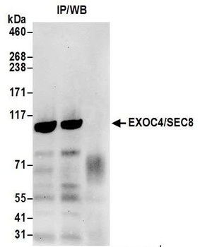 Rabbit EXOC4/SEC8 Antibody