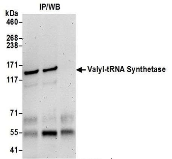 Rabbit Valyl-tRNA Synthetase/VARS Antibody
