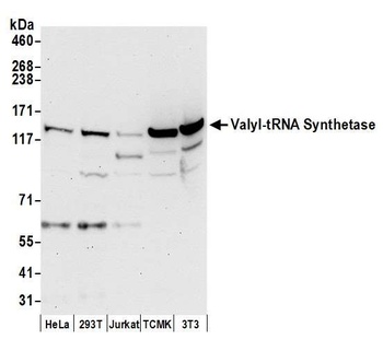 Rabbit Valyl-tRNA Synthetase/VARS Antibody