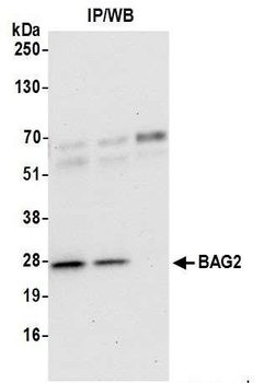 Rabbit BAG2 Antibody
