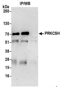 Rabbit anti-PRKCSH Antibody