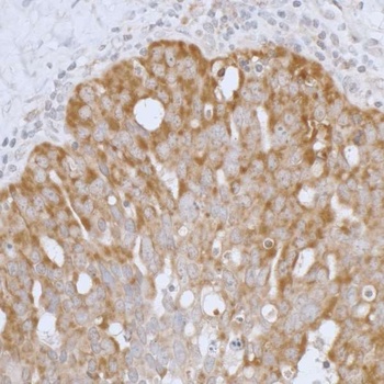 Rabbit Peroxiredoxin-3 Antibody
