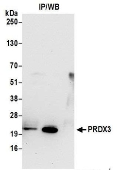 Rabbit Peroxiredoxin-3 Antibody