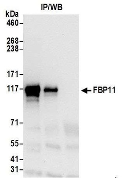 Rabbit FBP11 Antibody
