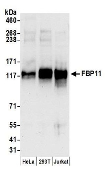 Rabbit FBP11 Antibody