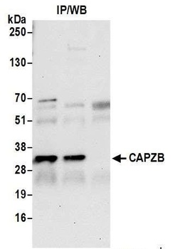 Rabbit CAPZB Antibody