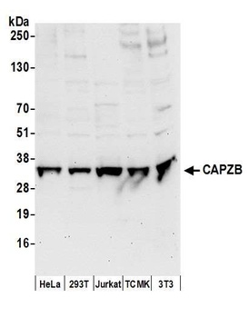 Rabbit CAPZB Antibody