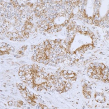 Rabbit DLD Antibody