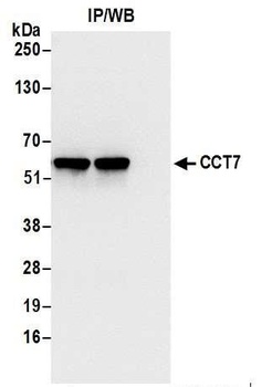 Rabbit CCT7 Antibody