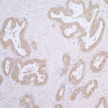 Rabbit CCT7 Antibody