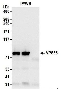 Rabbit VPS35 Antibody
