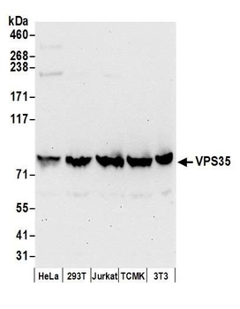 Rabbit VPS35 Antibody