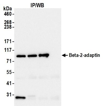 Rabbit Beta-2-adaptin Antibody