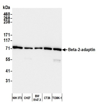 Rabbit Beta-2-adaptin Antibody