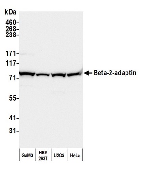 Rabbit Beta-2-adaptin Antibody