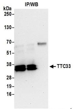 Rabbit TTC33 Antibody