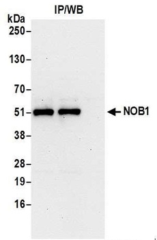 Rabbit NOB1 Antibody