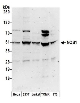 Rabbit NOB1 Antibody