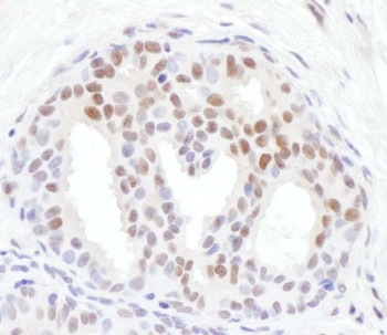Rabbit Phospho Chk1 (S317) Antibody