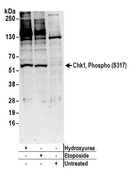 Rabbit Phospho Chk1 (S317) Antibody