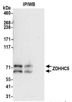 Rabbit ZDHHC5 Antibody
