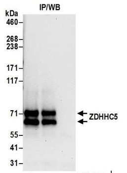 Rabbit ZDHHC5 Antibody
