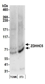 Rabbit ZDHHC5 Antibody