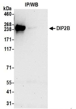 Rabbit DIP2B Antibody