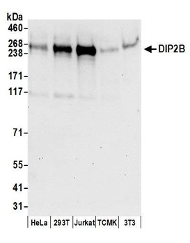 Rabbit DIP2B Antibody