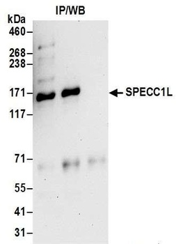Rabbit SPECC1L Antibody