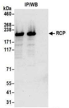 Rabbit RCP Antibody