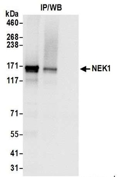 Rabbit NEK1 Antibody