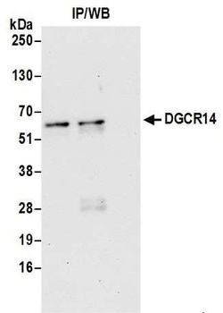 Rabbit DGCR14 Antibody