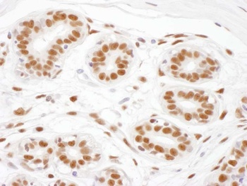 Rabbit ARS2 Antibody