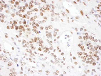 Rabbit ARS2 Antibody