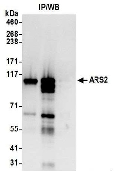 Rabbit ARS2 Antibody