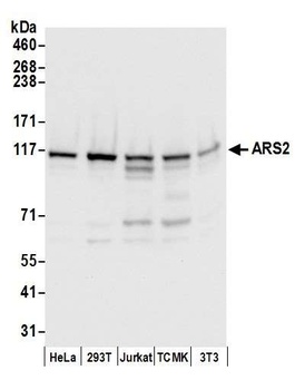 Rabbit ARS2 Antibody
