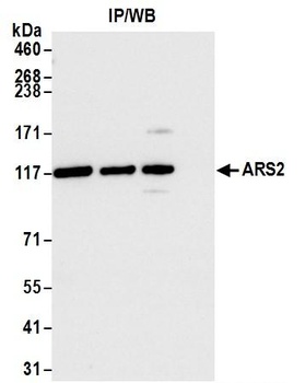 Rabbit ARS2 Antibody