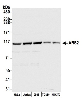 Rabbit ARS2 Antibody