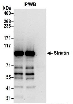 Rabbit Striatin Antibody