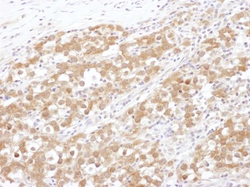 Rabbit NUDC Antibody