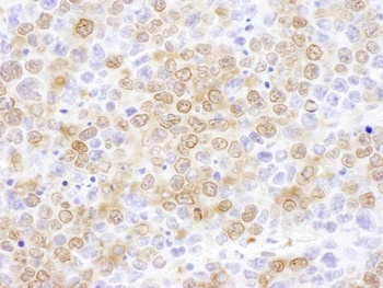 Rabbit NUDC Antibody