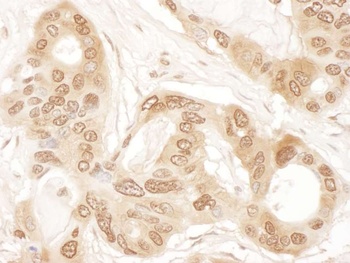 Rabbit ICLN Antibody
