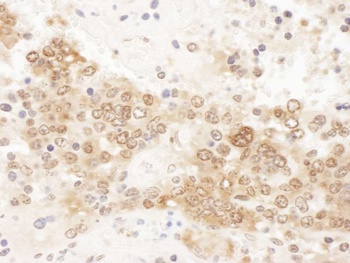 Rabbit ICLN Antibody