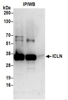 Rabbit ICLN Antibody