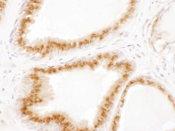 Rabbit p115 Antibody